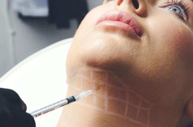 Double Chin Dissolving: Refine Your Profile Without Surgery