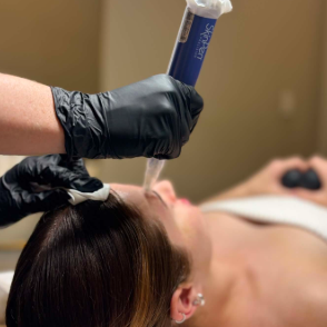 Skin Needling: The Treatment Your Skin Will Thank You For
